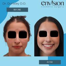 Envision Cosmetic Surgery: Dr. Benjamin Dunkley, 5417 S Commerce Dr, Ste  100, Salt Lake City, UT 84107, US