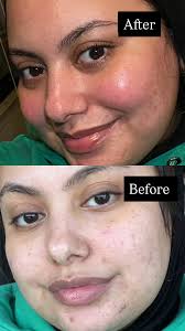 غسول بيوديرما ولا لاروش ولا افين لبشره مختلطه مايله لدهنيه تعديل: في حبوب