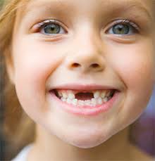 However, one should ensure that the tooth is either extremely loose or hanging. How Are You Going To Pull That Loose Tooth Blog Sparkle Dental