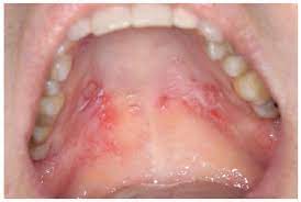 Jordi Journal Of Oral Diagnosis