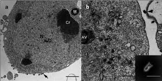 Generate free fire name, randomize user name with special beauty of character. Transmission Electron Microscopy Of Epithelioma Papulosum Cyprini Cells Download Scientific Diagram