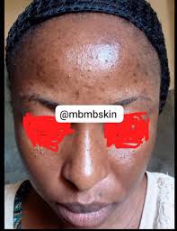 HOW TO MAKE LEMON OIL 🪔 Lemon oil lightens & it's very good for fading  dark spots