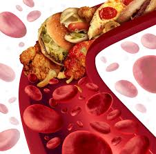 Kolesterol merupakan senyawa yang ditemukan pada lemak/ lipid dalam darah anda. Kolestrol Anda Tinggi Jika Kerap Kebas Tangan Kaki Sakit Dada Sakit Kepala June 2021 Kelabmama Malaysia