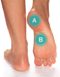 foot ailments arch plantar fasciitis footsmart