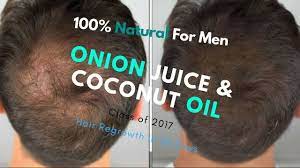 It has numerous uses from ailing diseases like alzheimer, arthritis, and blood pressure to boosting the brain's memory and functioning power to hair growth. Onion Juice Coconut Oil For Hair Regrowth In 30 Days 100 Hair Regrowth Onion Juice For Hair Coconut Oil Hair