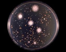 Image result for Cryptococcal Meningitis