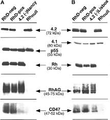 Evidence That The Red Cell Skeleton Protein 4 2 Interacts With The Rh Membrane Complex Member Cd47 Presented In Part At The 43rd Annual Meeting Of The American Society Of Hematology Orlando Fl