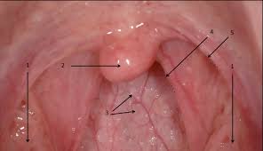 Image result for tonsilla palatina