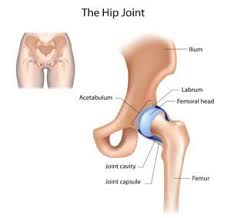 Image result for Hip Labral Tear