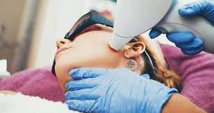 It can occur as a result of childbirth, menopause, weakened pelvic muscles, and the natural aging process. How Much Does Laser Hair Removal Cost