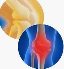 Eklem Agrilari Icin Bitkisel Kurler Dogal Ve Guzel Saglik Bitki Saglikli Yasam