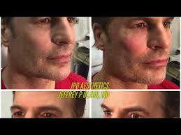 Jeffrey Patrick Olson