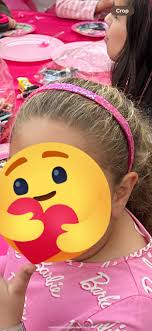 Hair loss after starting methylphenidate?