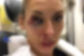 Horrific assault" at the centre of a GoFundMe campaign disputed by VPD