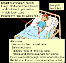 Image result for Shifting Dullness Test