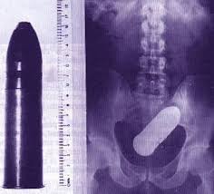 31 Funny X Ray Images That Seem Too Ridiculous To Be Real 800+ vectors, stock photos & psd files. 31 funny x ray images that seem too