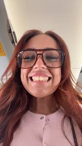 I got £4K Turkey teeth even though they won't last past my 35th birthday