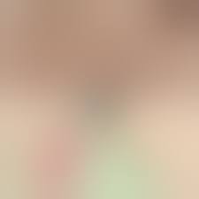 Возможное вызывание аллергии