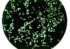 Image result for Shigella