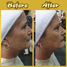 I-24K yeGolide yeCollagen ixobula imaski-Ayithengiswa ezivenkileni