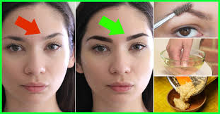 You cant reduce white hair. Eyebrow Hair Loss Causes And Prevention Tips