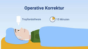 Wann ist eine operation am grauen star sinnvoll? Grauer Star Und Die Schonende Operation Grauer Star Operation In Munchen Augenzentrum