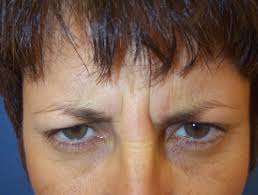 These toxins are some of the most powerful known to science. Botulinum Toxin Dermnet Nz