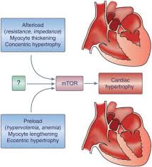 Image result for Preload