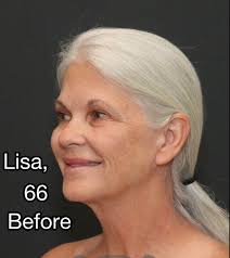 Conjoined Twins, 3, Get Separated in Historic Surgery, See Each Other for  the 1st Time since Birth