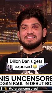 Dillon Danis Leonardo