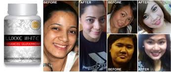 Number 1 glutathione in the Philippines