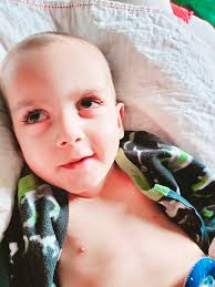 Killian is a rare disease advocate from rural Queensland. In his own words,  Killian is 'gay, trans, disabled