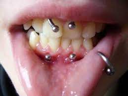 Smiley Piercing Anti Smiley Piercing Healing Infection Risks Pain Aftercare