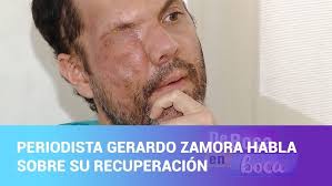 Rising from the Ashes: The Story of a Costa Rican Doctor