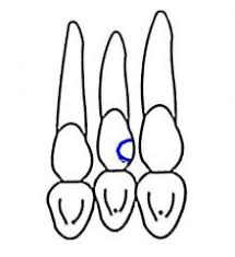 Dental Charting Flashcards Cram Com