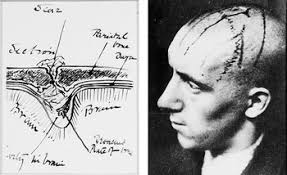 The Grammar of Neurosurgery: Technical Underpinnings (Chapter 6)