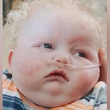 Hershey Congenital Heart Walk