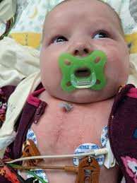 When wounds are healed by love, scars are beautiful