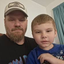 Her genetic condition is similar to childhood dementia, as it leads to  brain atrophy over time.#medicallycomplex #MCAHS1 #pign #fyp #cdg #foryou  #viral #epilepsy #rare #hope4hazel #raredisease #medical #hospital #doctor  #terminal