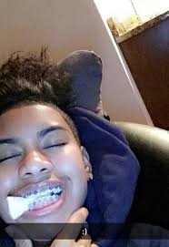 Bestofliberty Cute Braces Brace Face Guys With Braces