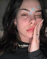 Body Positivity: Diese Stars lieben ihre einzigartigen Körper | GALA.de