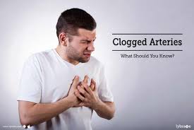 If these arteries become clogged, it can. Clogged Arteries What Should You Know By Dr Pramod Kumar Sharma Lybrate