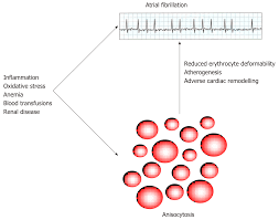 Image result for Red Cell Distribution Width