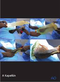 Lateral Recumbency Position