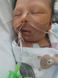 Lennix's Progress with Hypoplastic Left Heart Syndrome