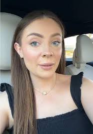 Mawala ang Melasma sa Suhada Melasma Soap