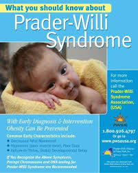 Pin On Prader Willi