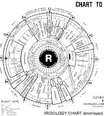 Iridology The Skeptics Dictionary Skepdic Com