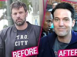 Celebrity plastic surgery before & after (56 pics). Bad Plastic Surgery Rumors 5 Male Celebrities Men S Variety