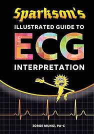 Free Download Pdf Sparksons Illustrated Guide To Ecg Interpretation Free Epub Mobi Ebooks Ecg Interpretation Interpretation Book Format